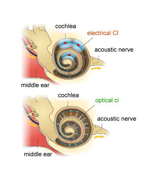 Fraunhofer-IPMS-Optogenetic-OLED-on-CMOS-eng.jpg